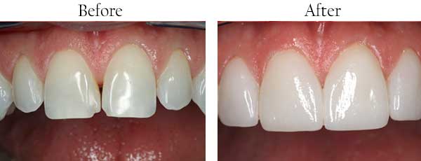 West Passyunk dental images